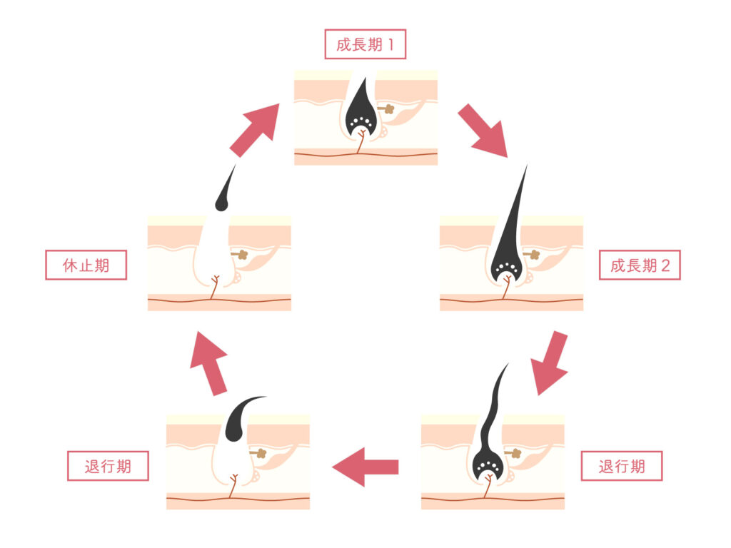 毛周期(成長期1・成長期2・退行期・休止期)についてをイラストで表している画像