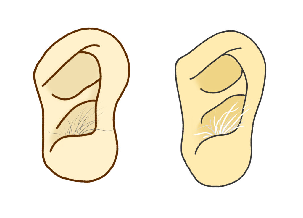 耳から毛、白髪が生えている状態のイラスト